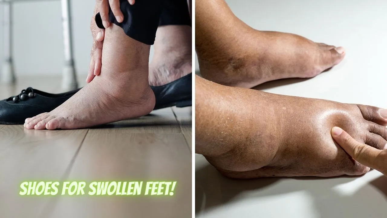 Best Shoes For Swollen Feet